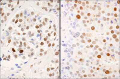 Immunohistochemistry: MCM2 [p Ser53] Antibody [NB100-2339]